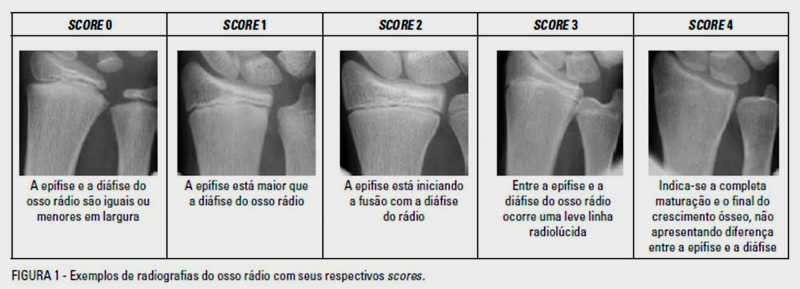 Arquivo:Epífise e Diáfise .png