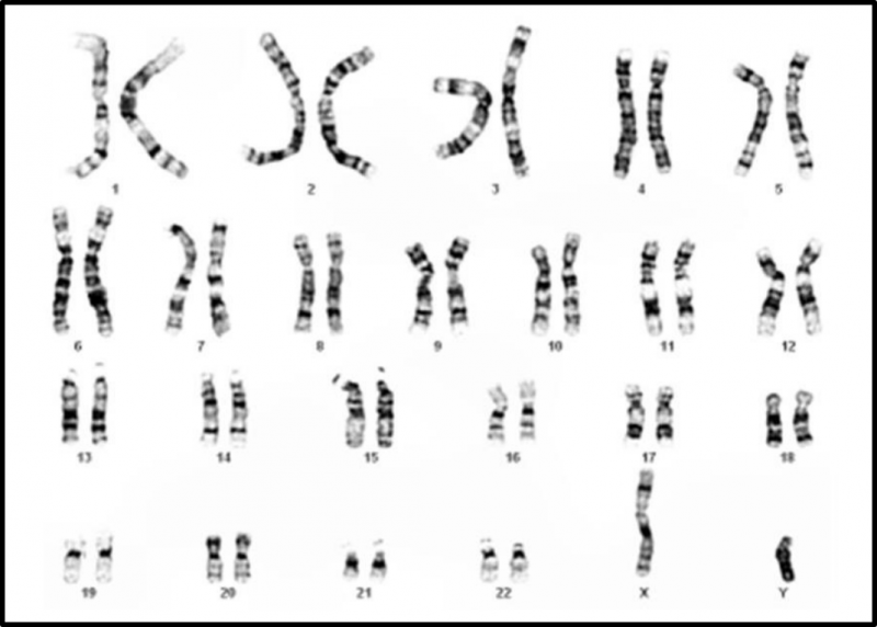Arquivo:Cariotipo Humano.png